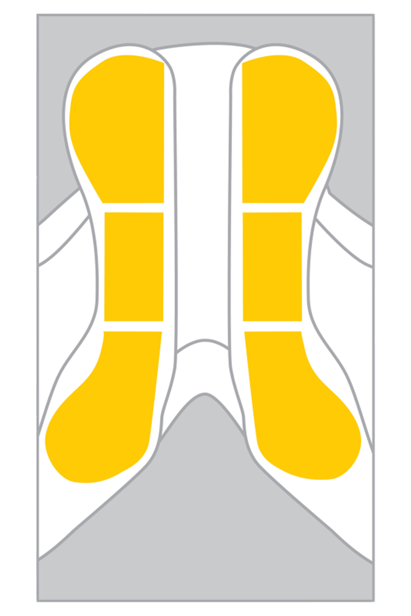 Wintec Easy-Change Riser Set di avviamento, Standard