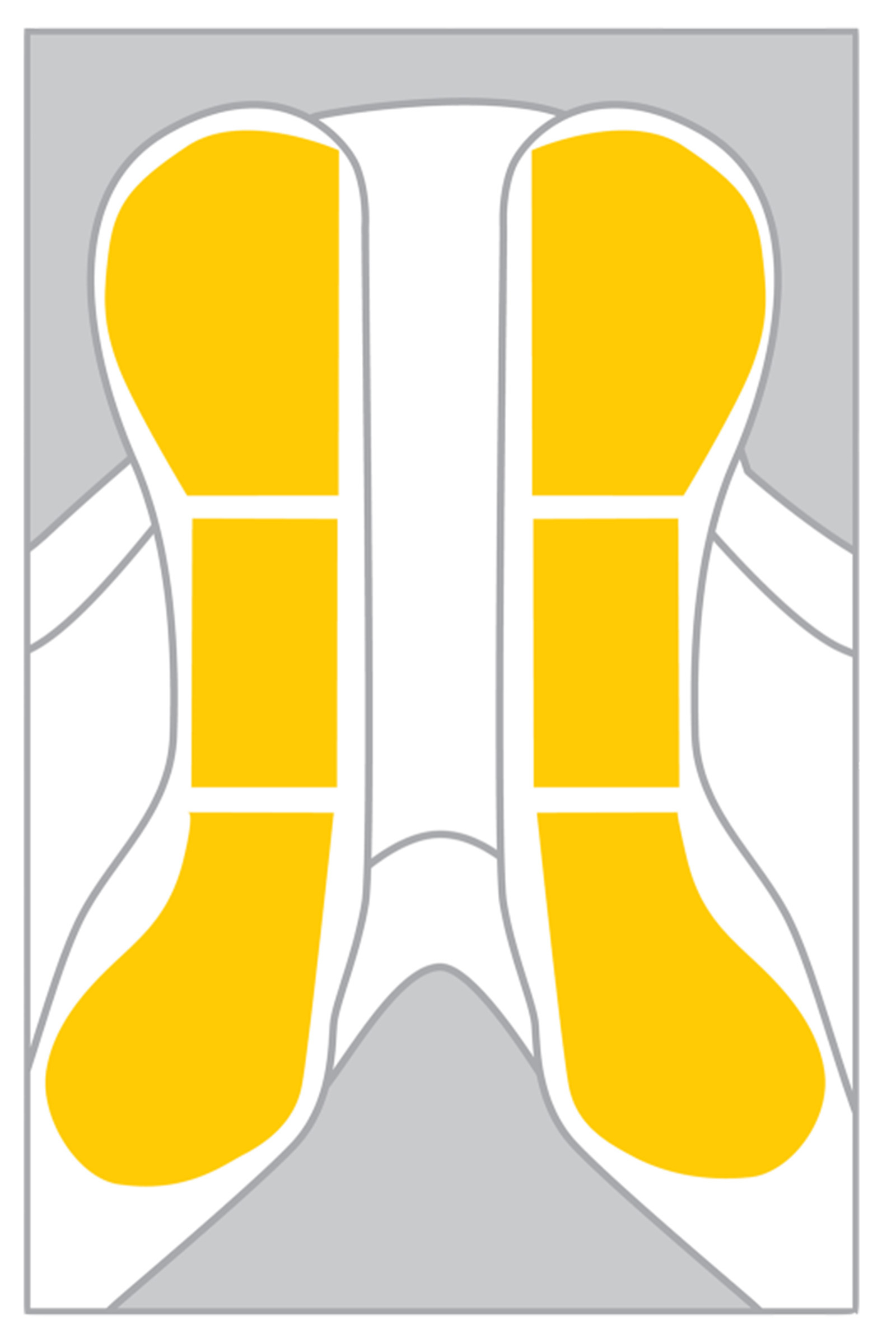 Wintec Set di riser EASY-CHANGE per pony